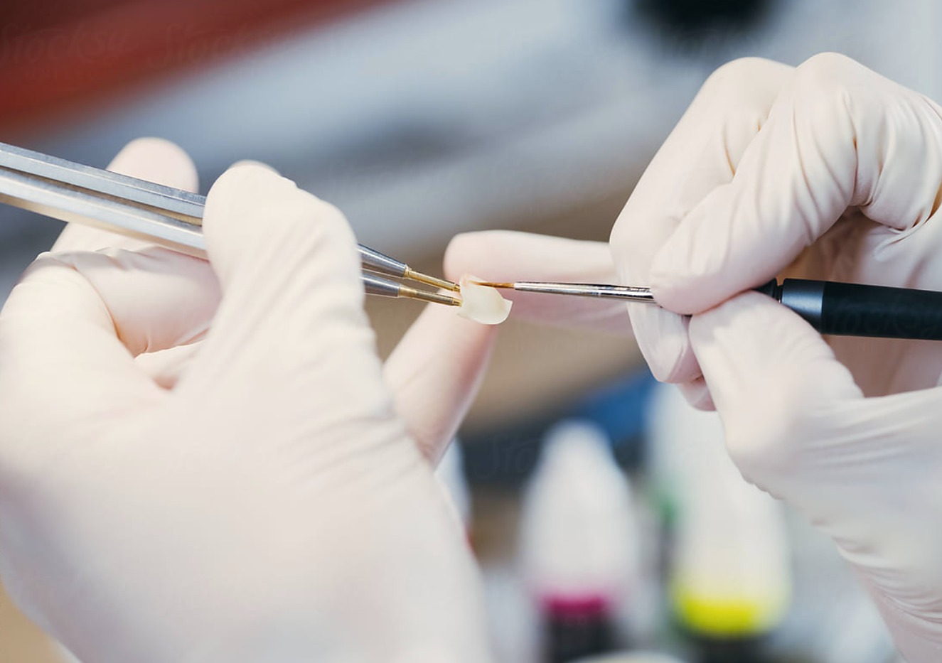 الجراحة السنية 